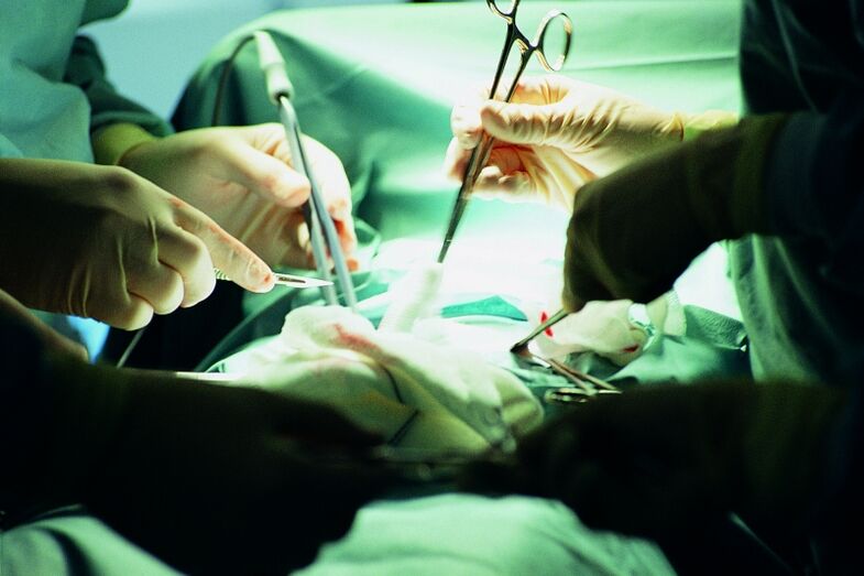 χειρουργική αύξηση του πάχους του πέους